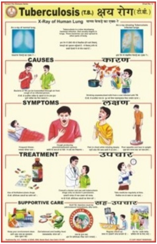 Prevent Diseases Charts