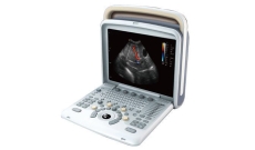 Ultrasound & Colour Doppler Machine