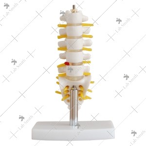 Mini Lumbar Vertebrae with Sacrum & Coccyx and Herniated Disc