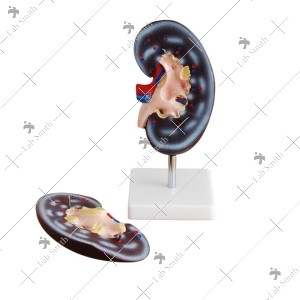 Kidney Model (2 parts)