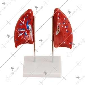 Lung Model
