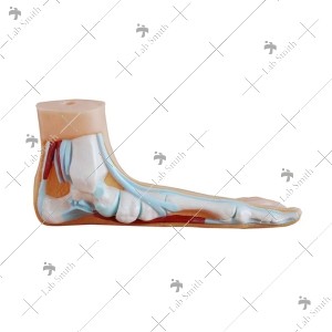Flat Foot