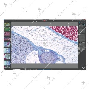 PROGRES GRYPHAX® Software Solution