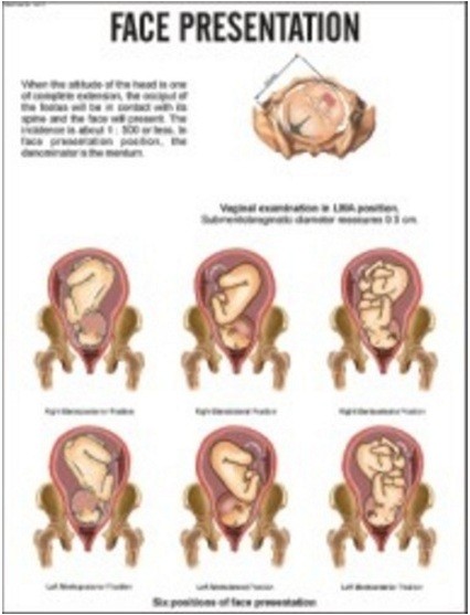 Face Presentation Chart