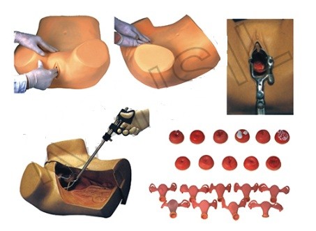 Gynecological Examination Model