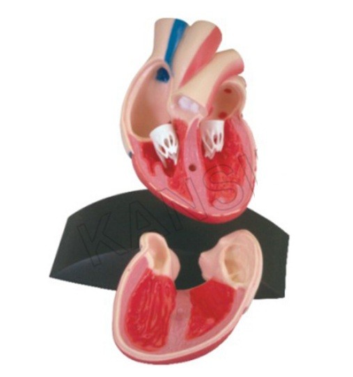 Heart Model