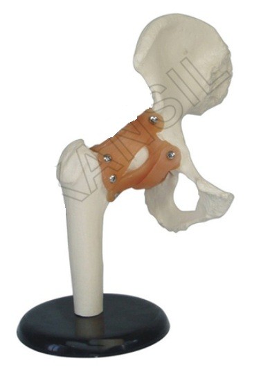 Hip Joint Model