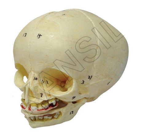 Infant Skull Model