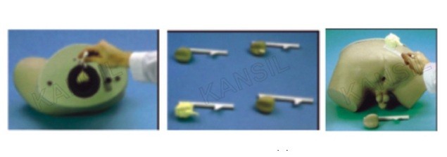 Prostate Inspection Model
