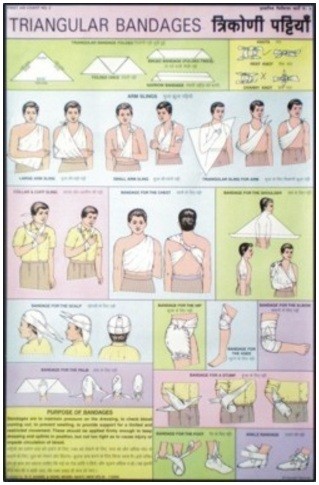 Triangular bandages Chart