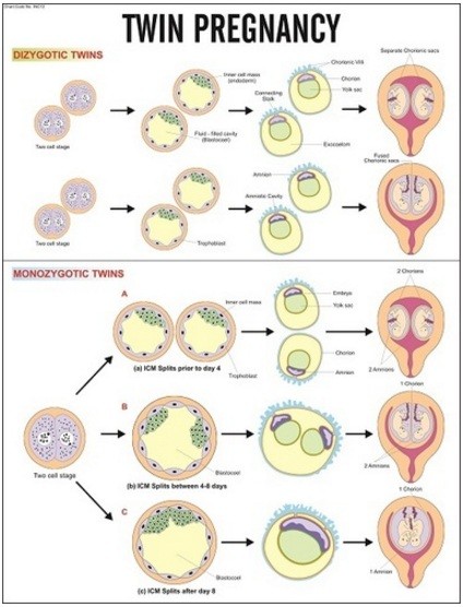 Twin Presentation Chart