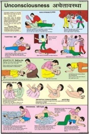 Unconsciousness Chart