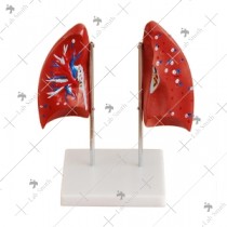 Lung Model