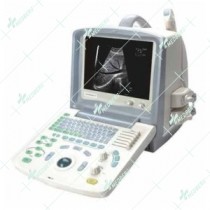Ultrasound Scanner