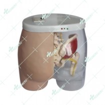 Intramuscular Injection Model