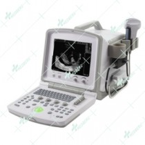 Doppler Ultrasound Scanner