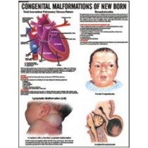 Congenital Malformation of New Born Chart