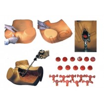 Gynecological Examination Model
