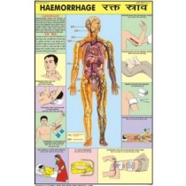 Haemmorhage Chart