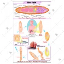 Liver Fluke