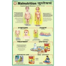 Malnutrition Chart