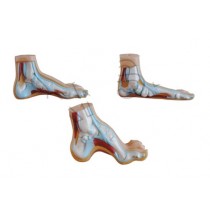 Normal, Flat and Arched Foot Model