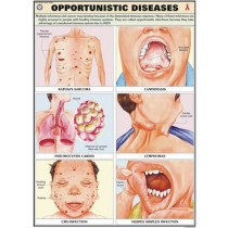 Opportunistic Diseases