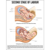 Second Stage of labour
