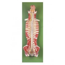 Spinal Cord in the Spinal Canal Model