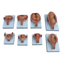The Development Process of Fetus (Half Size) Model