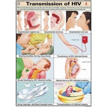 Transmission of HIV