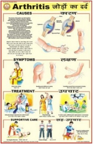 Arthritis
