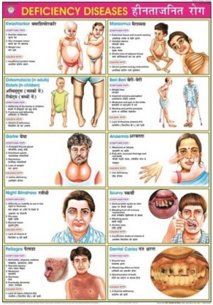 Deficiency Diseases Chart