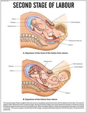 Second Stage of labour