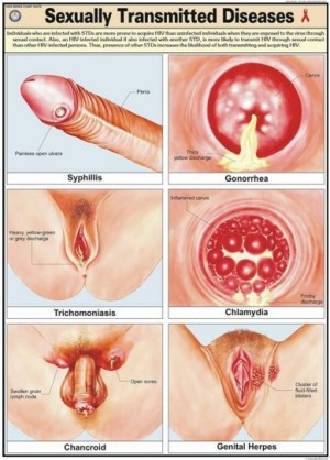 Sexually Transmitted Diseases