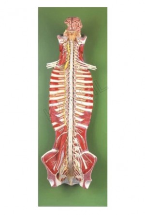 Spinal Cord in the Spinal Canal Model
