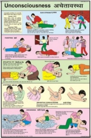 Unconsciousness Chart