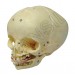 Infant Skull Model