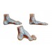 Normal, Flat and Arched Foot Model