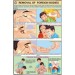 Removal of Foreign bodies Chart
