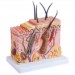 Skin Block Model