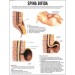 Spina Bifida Chart